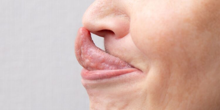 23 signs you grew up with ehlers-danlos syndrome