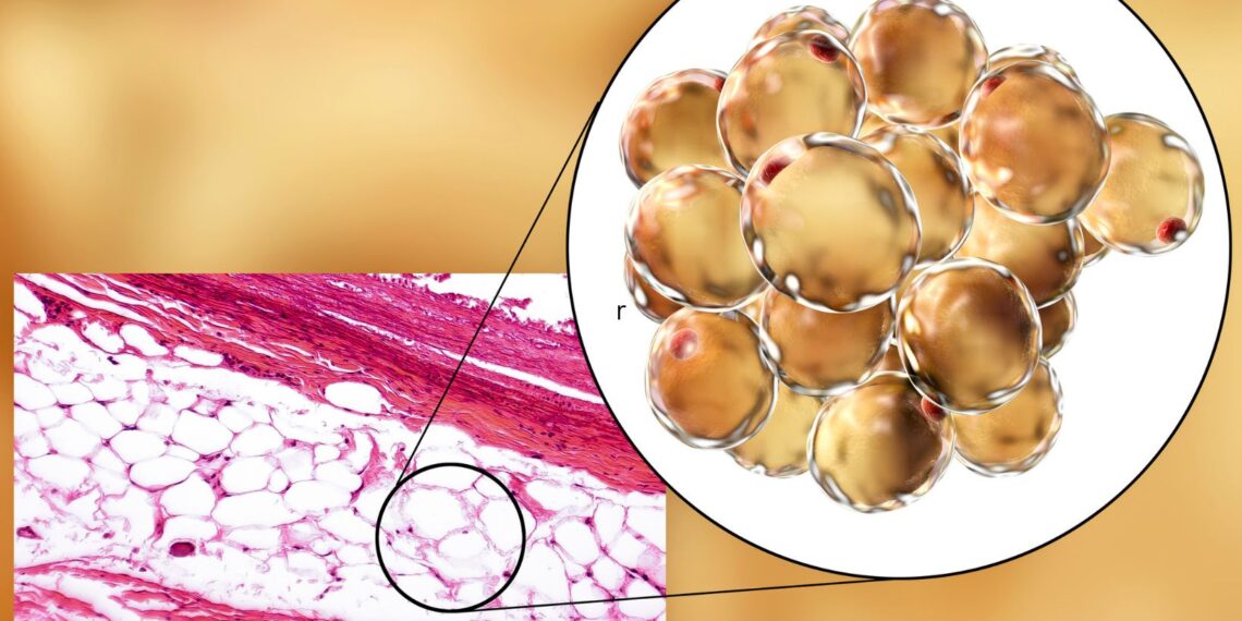 which statement accurately describes brown adipose tissue