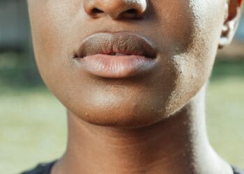 why do i get a white film on my lips