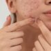 menarche is a maturational milestone most directly associated with
